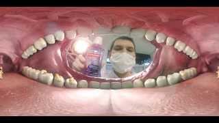 口の中の虫歯菌をマウスウォッシュで退治するVR動画
